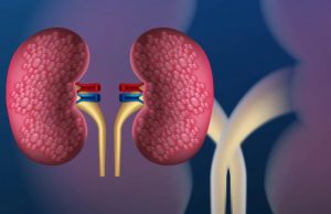 What is Kidney Cancer? Kidney Cancer