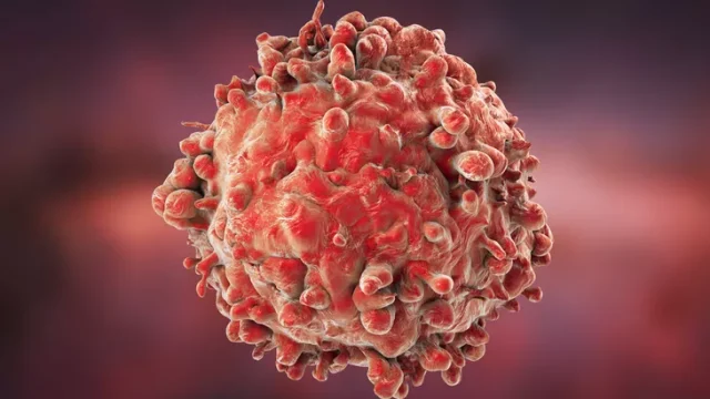 Leukemia