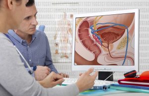 What is Prostate Cancer? Prostate Cancer