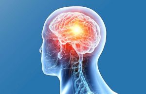 What is Brain Cancer? What is Brain Cancer?