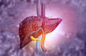 What is Liver Cancer? What is Liver Cancer?