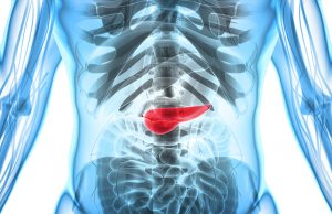 What is Pancreatic Cancer? What is Pancreatic Cancer?
