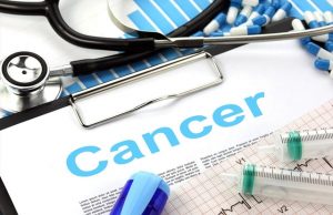 How Cancer is Diagnosed: The Tests and Procedures Involved How Cancer is Diagnosed: The Tests and Procedures Involved