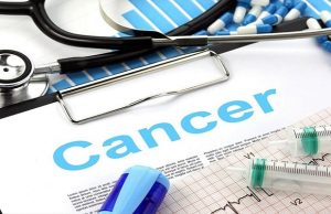 How to Beyond Chemotherapy: Alternative and Complementary Therapies for Cancer How to Beyond Chemotherapy: Alternative and Complementary Therapies for Cancer