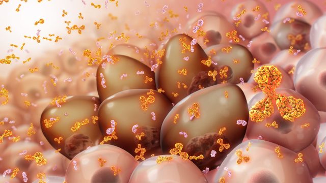What is Multiple Myeloma?