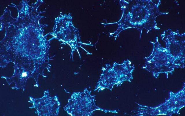 The Cutting Edge of Early Detection: Unveiling the Latest Advances in Cancer Screening