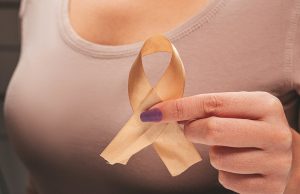 What Happens After a Cancer Screening? Understanding the Follow-Up Process What Happens After a Cancer Screening? Understanding the Follow-Up Process