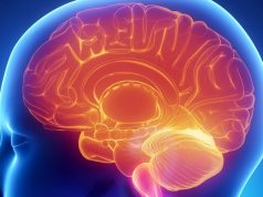 Primary CNS Lymphoma Demystified: Your Essential Guide to Understanding This Rare Brain Cancer Primary CNS Lymphoma