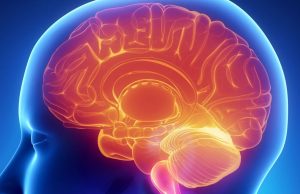 Primary CNS Lymphoma Demystified: Your Essential Guide to Understanding This Rare Brain Cancer Primary CNS Lymphoma