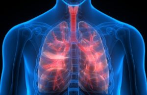 Lung Cancer Come Back After Surgery