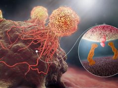 Lung Cancer By Smoking