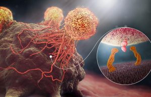 Lung Cancer By Smoking
