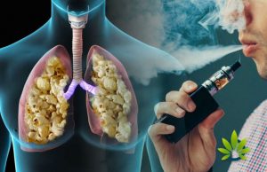 Lung Cancer From Vaping Reddit