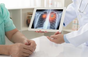 Lung Cancer Results