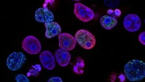 Automated Tissue Image Analysis and Deep Learning Algorithms in Cellular Pathology: Diagnostic Algorithmic Validation, Morphometric Feature Extraction & Quality Control Standards - Featured Image